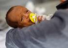 LA ONU DENUNCIÓ QUE LOS NIÑOS MUEREN DESNUTRIDOS EN GAZA A LA ESPERA DE ALIMENTOS
